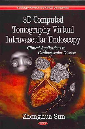 3D Computed Tomography Virtual Intravascular Endoscopy