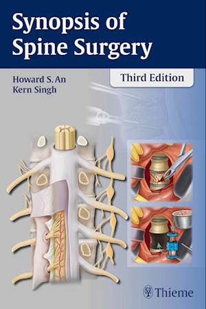 Synopsis of Spine Surgery