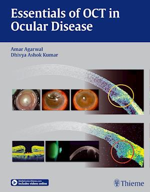 Essentials of Oct in Ocular Disease