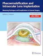 Phacoemulsification and Intraocular Lens Implantation: Mastering Techniques and Complications in Cataract Surgery