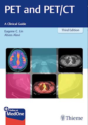 PET and PET/CT: A Clinical Guide