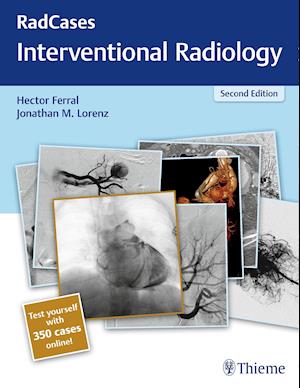 Radcases Interventional Radiology