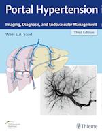 Portal Hypertension