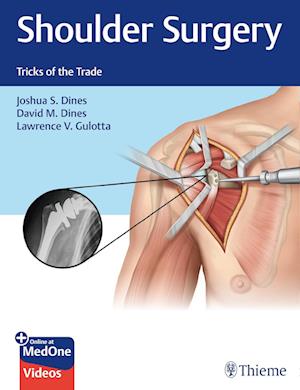 Shoulder Surgery : Tricks of the Trade