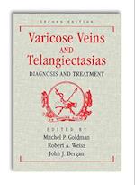 Varicose Veins and Telangiectasias