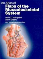 Atlas of Flaps of the Musculoskeletal System