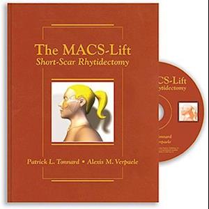 The Macs-Lift