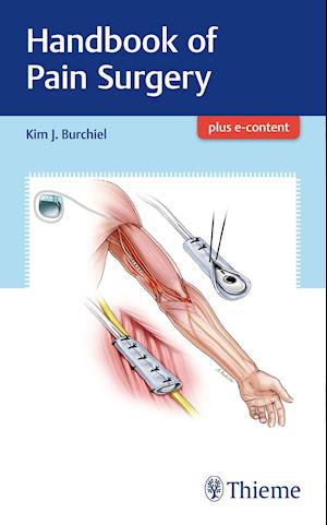 Handbook of Pain Surgery