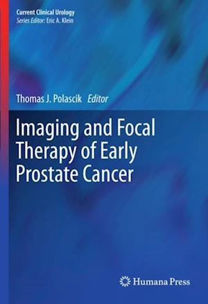 Imaging and Focal Therapy of Early Prostate Cancer