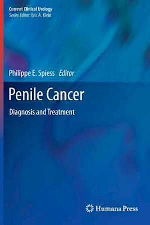 Penile Cancer