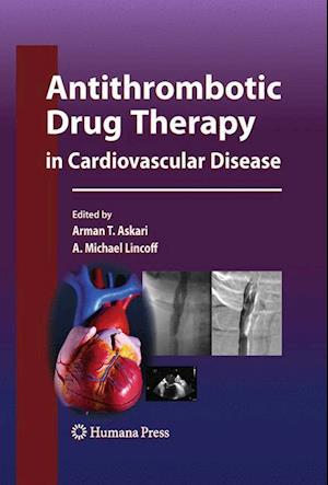 Antithrombotic Drug Therapy in Cardiovascular Disease