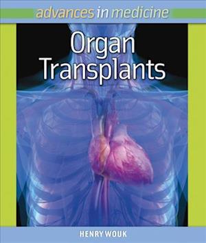 Organ Transplants