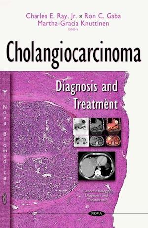 Cholangiocarcinoma