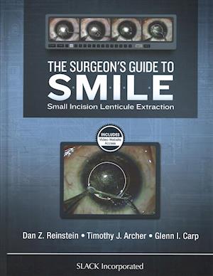 The Surgeon’s Guide to SMILE