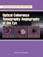 Optical Coherence Tomography Angiography of the Eye