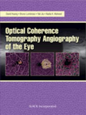Optical Coherencre Tomography Angiography of the Eye
