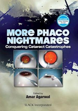 More Phaco Nightmares