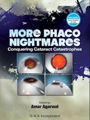 More Phacoo Nightmares