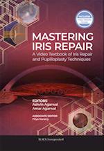 Mastering Iris Repair