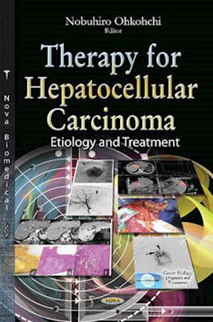 Therapy for Hepatocellular Carcinoma