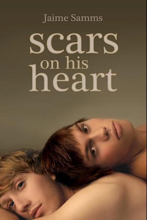 Scars on His Heart