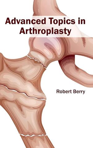 Advanced Topics in Arthroplasty