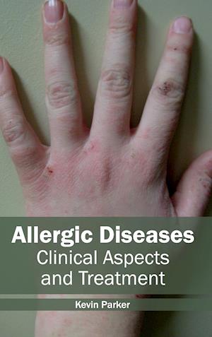 Allergic Diseases