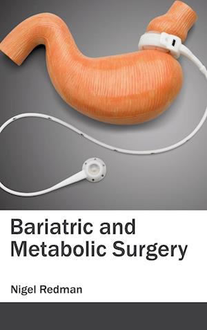 Bariatric and Metabolic Surgery