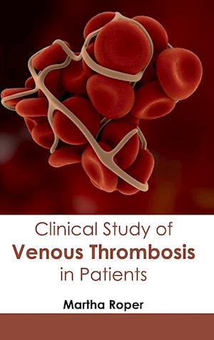 Clinical Study of Venous Thrombosis in Patients