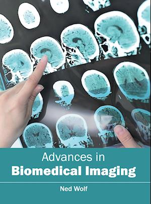 Advances in Biomedical Imaging