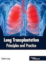 Lung Transplantation