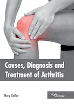 Causes, Diagnosis and Treatment of Arthritis