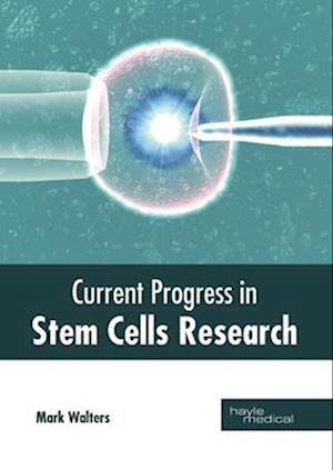 Current Progress in Stem Cells Research