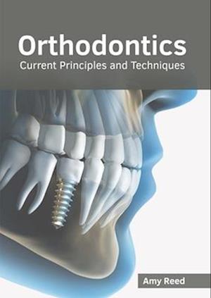 Orthodontics: Current Principles and Techniques