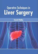 Operative Techniques in Liver Surgery