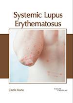 Systemic Lupus Erythematosus