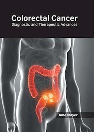 Colorectal Cancer: Diagnostic and Therapeutic Advances