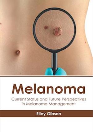 Melanoma