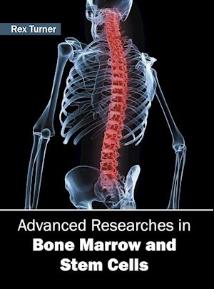 Advanced Researches in Bone Marrow and Stem Cells