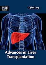 Advances in Liver Transplantation