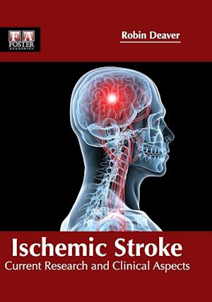 Ischemic Stroke