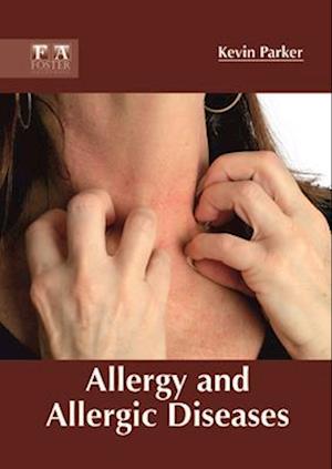 Allergy and Allergic Diseases