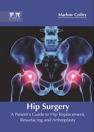 Hip Surgery: A Patient's Guide to Hip Replacement, Resurfacing and Arthroplasty