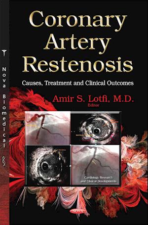 Coronary Artery Restenosis