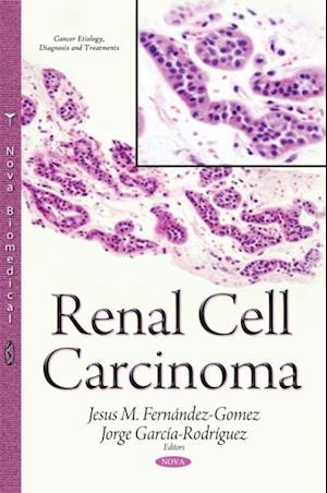 Renal Cell Carcinoma