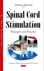 Spinal Cord Stimulation