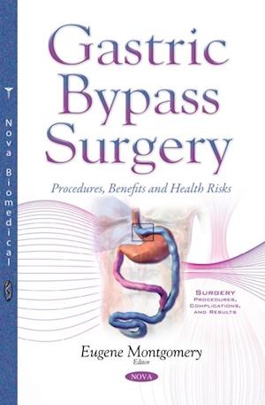 Gastric Bypass Surgery