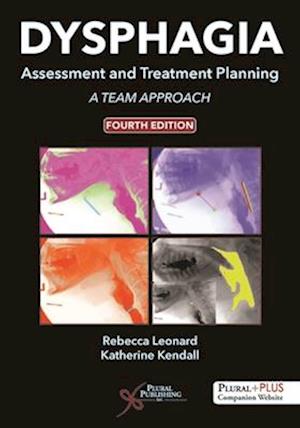 Dysphagia Assessment and Treatment Planning