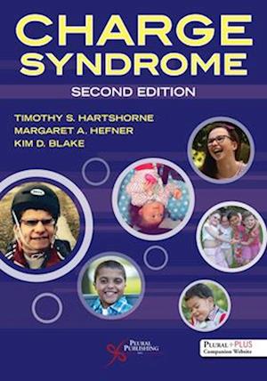 CHARGE Syndrome