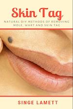 Skin Tag : Natural DIY Methods of removing Mole, Wart and Skin Tag 